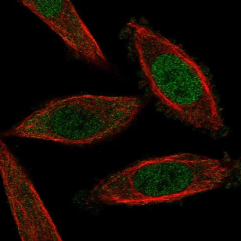 NFAT5 Antibody Immunocytochemistry/Immunofluorescence: NFAT5 Antibody [NBP3-25012]