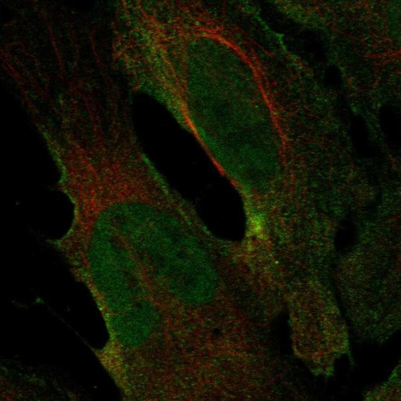 Nicotinic Acetylcholine R alpha 2/CHRNA2 Antibody Immunocytochemistry/Immunofluorescence: Nicotinic Acetylcholine R alpha 2/CHRNA2 Antibody [NBP3-25016]