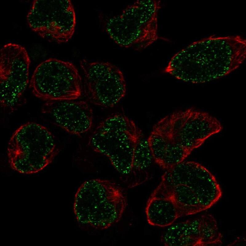 NKX2.6 Antibody Immunocytochemistry/Immunofluorescence: NKX2.6 Antibody [NBP3-25018]