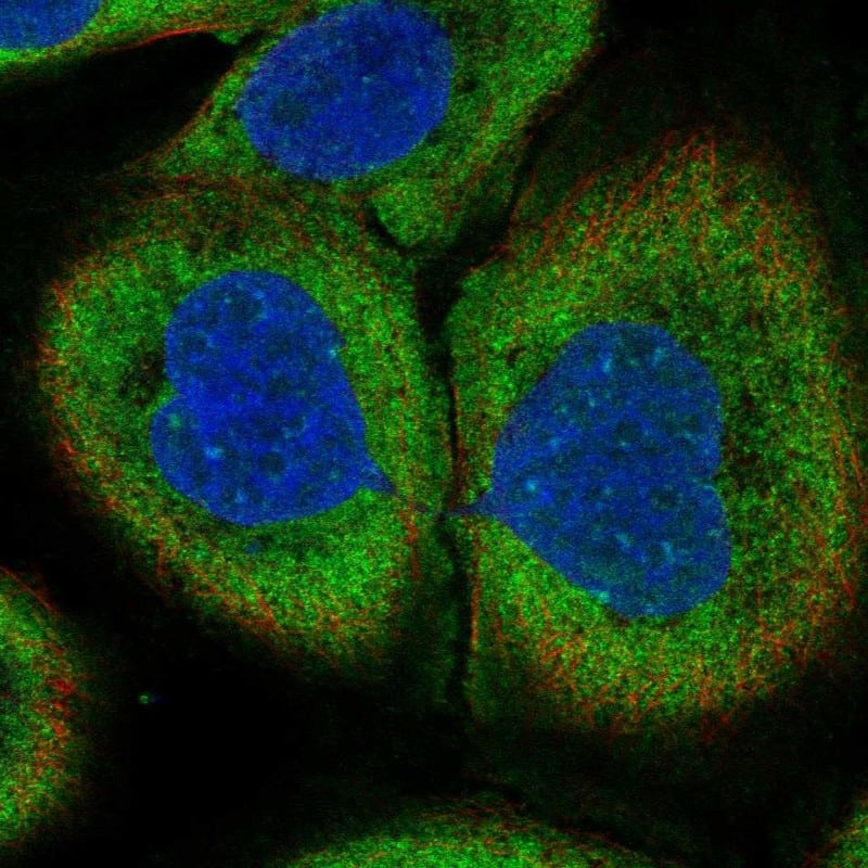 NT5C3 Antibody Immunocytochemistry/Immunofluorescence: NT5C3 Antibody [NBP3-25024]