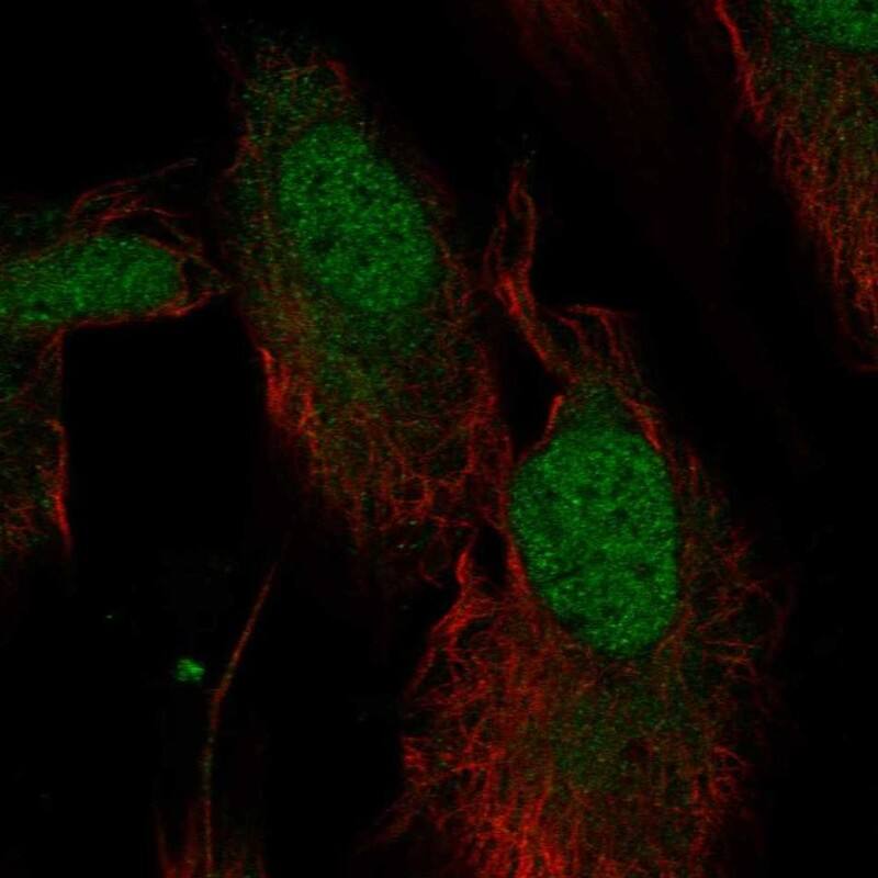 NT5DC1 Antibody Immunocytochemistry/Immunofluorescence: NT5DC1 Antibody [NBP3-25025]