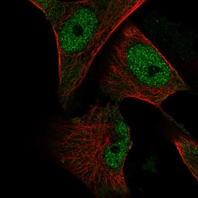 OASIS/CREB3L1 Antibody Immunocytochemistry/Immunofluorescence: OASIS/CREB3L1 Antibody [NBP3-25027]