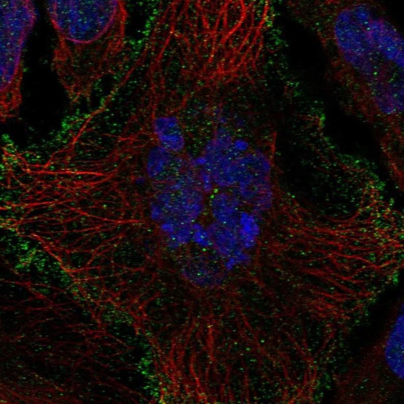 OATP1B1/OATP2 Antibody Immunocytochemistry/Immunofluorescence: OATP1B1/OATP2 Antibody [NBP3-25028]