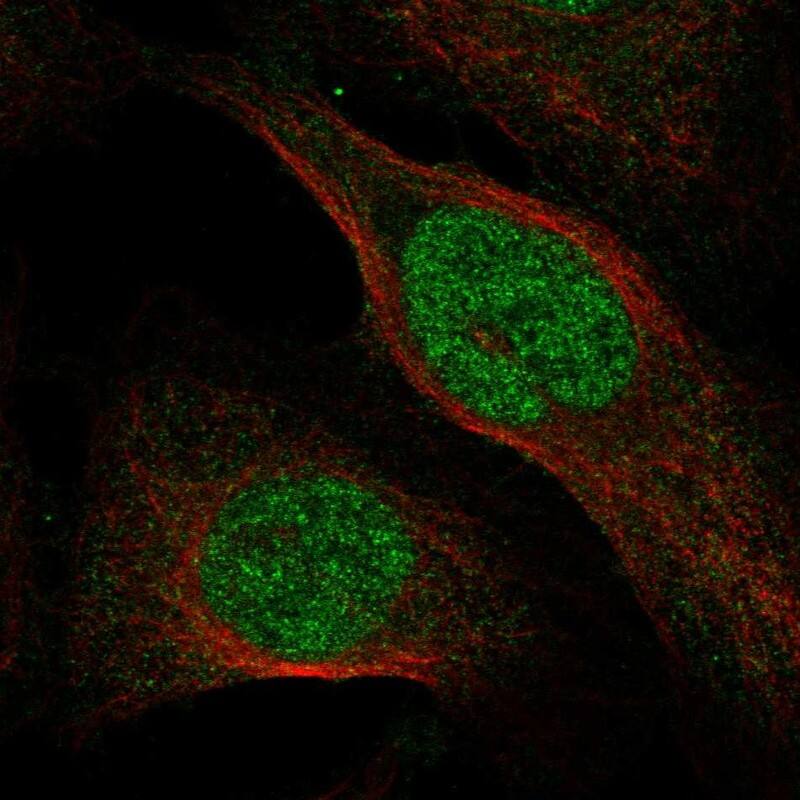 OSGEP Antibody Immunocytochemistry/Immunofluorescence: OSGEP Antibody [NBP3-25030]