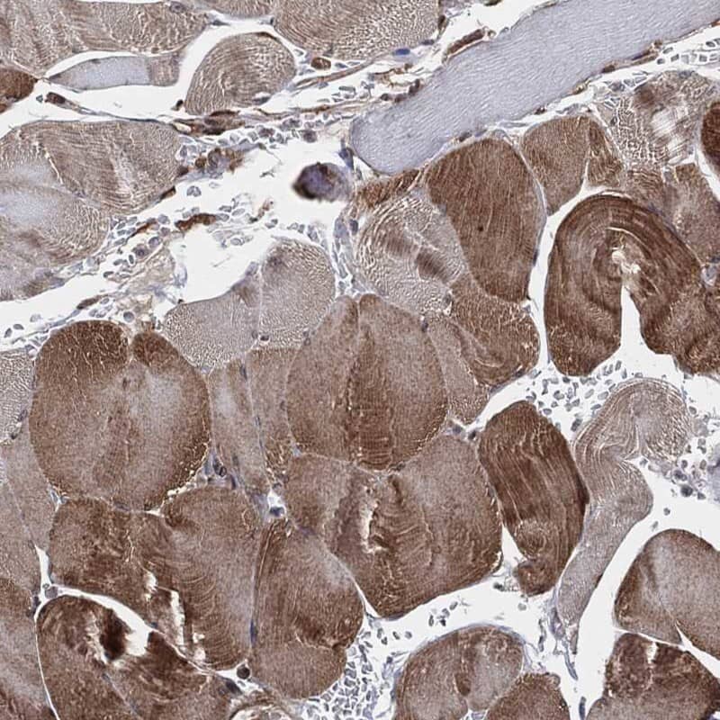 p130Cas/BCAR1 Antibody Immunohistochemistry-Paraffin: p130Cas/BCAR1 Antibody [NBP3-25033]