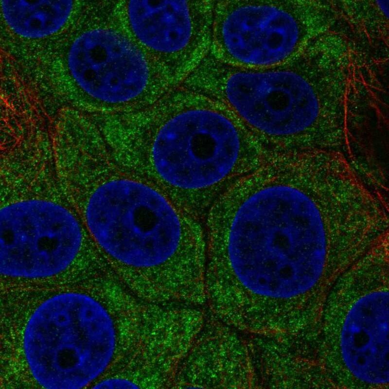 p38 beta/MAPK11 Antibody Immunocytochemistry/Immunofluorescence: p38 beta/MAPK11 Antibody [NBP3-25035]