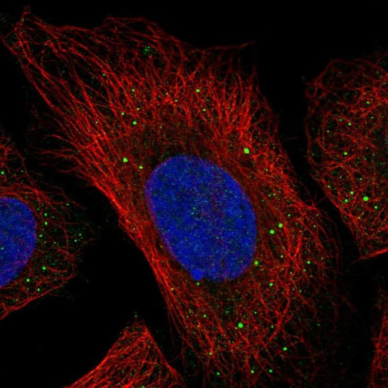 p40 Antibody Immunocytochemistry/Immunofluorescence: p40 Antibody [NBP3-25036]