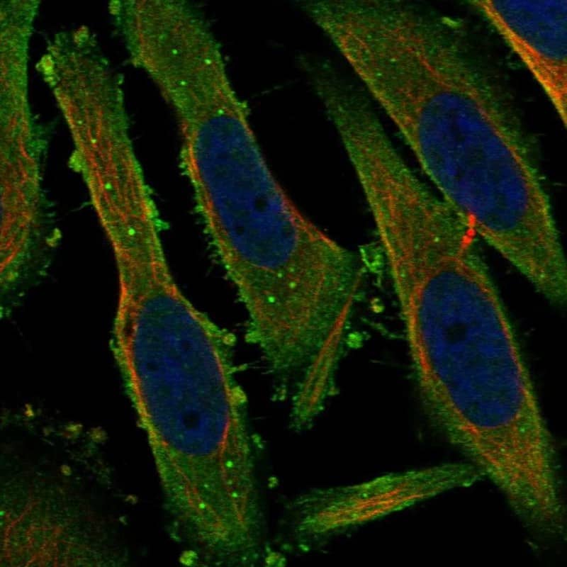 PACS1 Antibody Immunocytochemistry/Immunofluorescence: PACS1 Antibody [NBP3-25037]