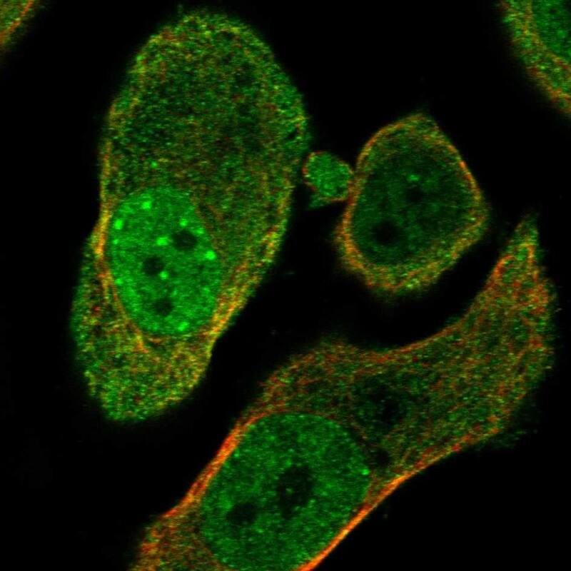 PARG Antibody Immunocytochemistry/Immunofluorescence: PARG Antibody [NBP3-25040]