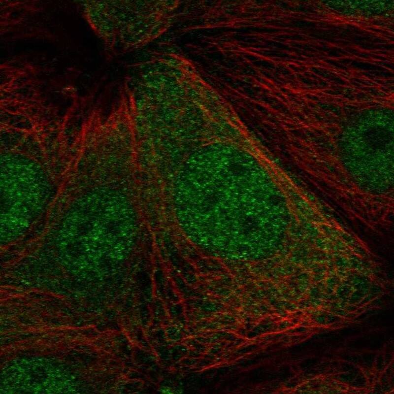 PBOV1 Antibody Immunocytochemistry/Immunofluorescence: PBOV1 Antibody [NBP3-25041]