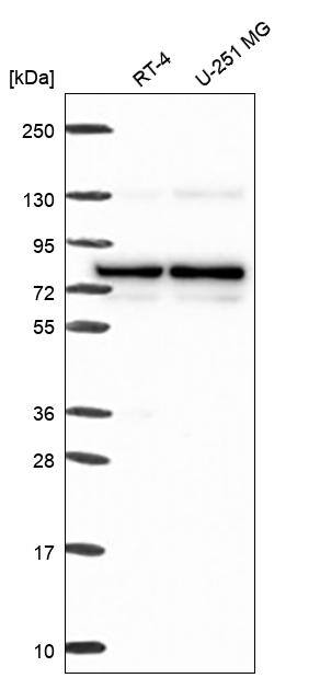 PBXIP1 Antibody Western Blot: PBXIP1 Antibody [NBP3-25042]