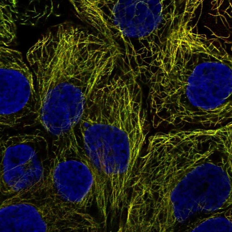 PDCL2 Antibody Immunocytochemistry/Immunofluorescence: PDCL2 Antibody [NBP3-25043]