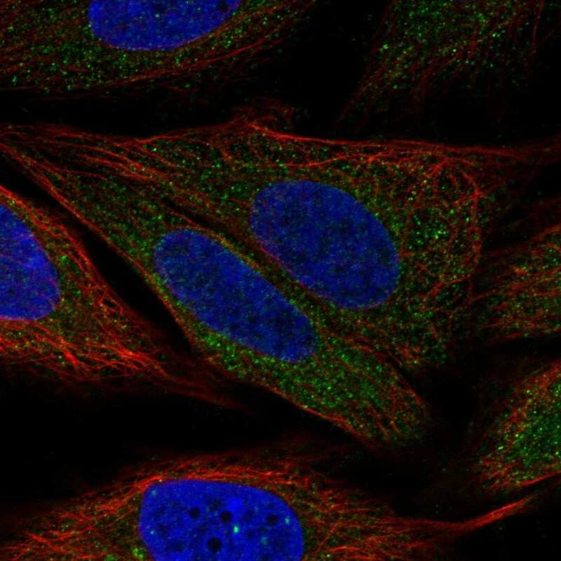 PDK-1 Antibody - BSA Free Immunocytochemistry/ Immunofluorescence: PDK-1 Antibody [NBP3-25044]