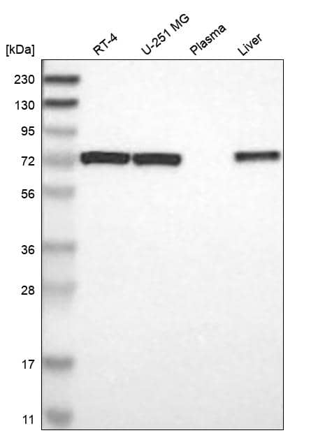 PDK-1 Antibody Western Blot: PDK-1 Antibody [NBP3-25044]