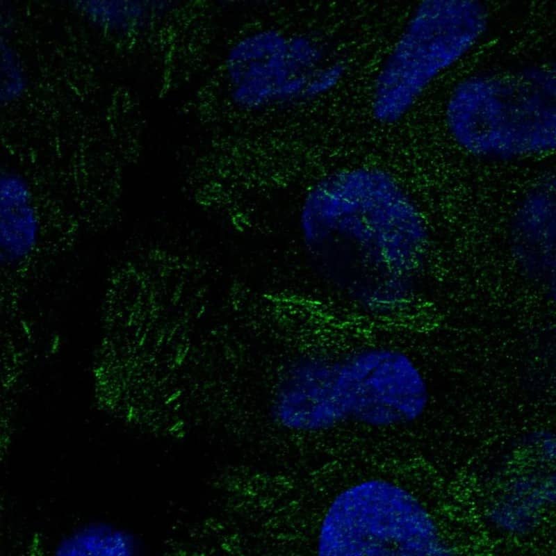 PEAK1 Antibody Immunocytochemistry/Immunofluorescence: PEAK1 Antibody [NBP3-25045]