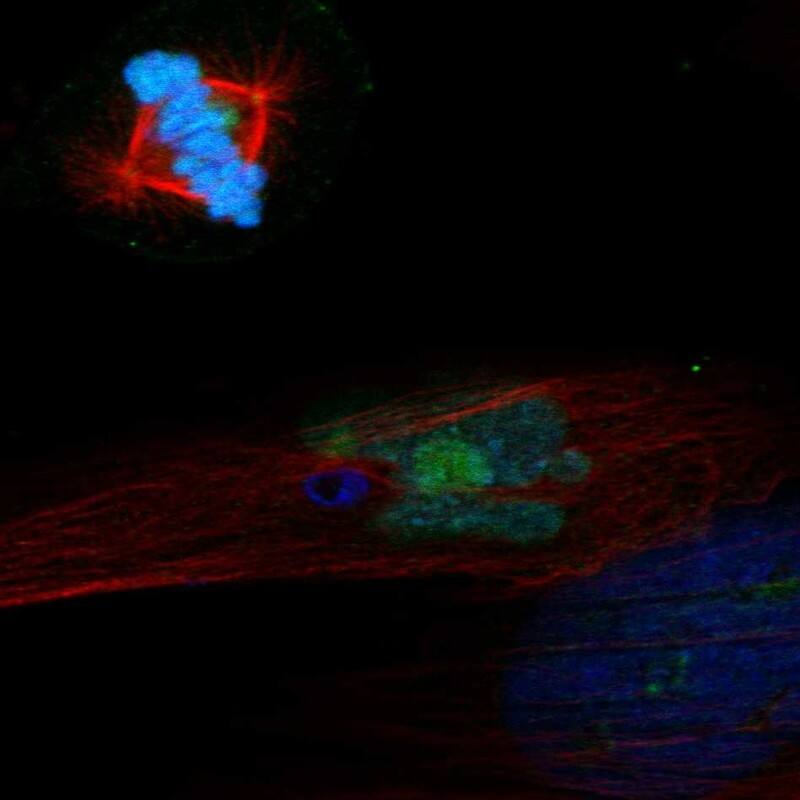 PELO Antibody Immunocytochemistry/Immunofluorescence: PELO Antibody [NBP3-25047]