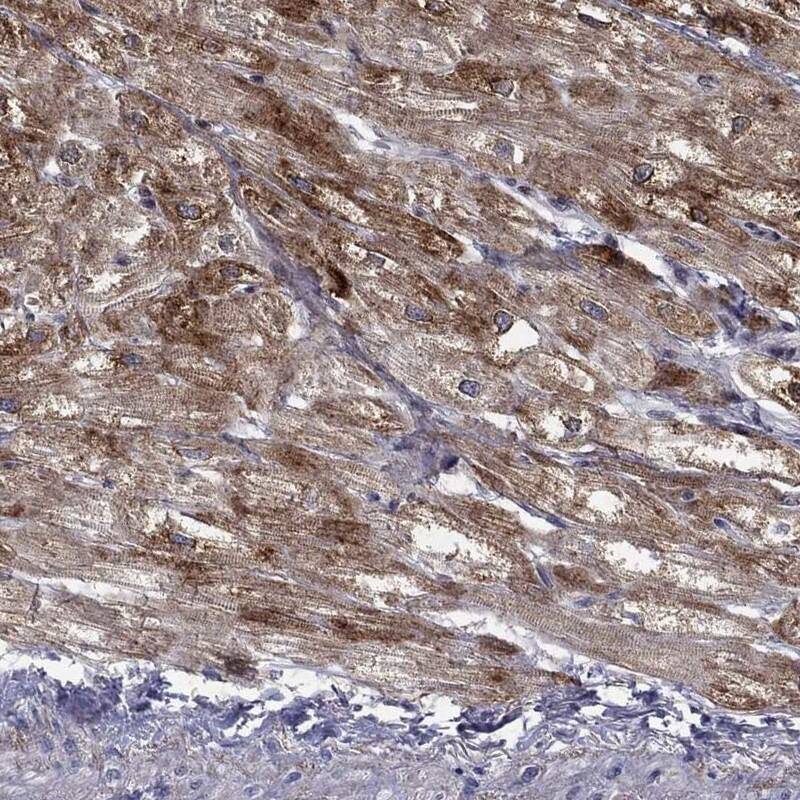 PGD2 Synthase/PTGDS Antibody Immunohistochemistry-Paraffin: PGD2 Synthase/PTGDS Antibody [NBP3-25049]