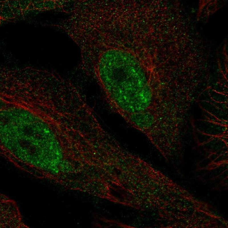 PHF1 Antibody Immunocytochemistry/Immunofluorescence: PHF1 Antibody [NBP3-25050]