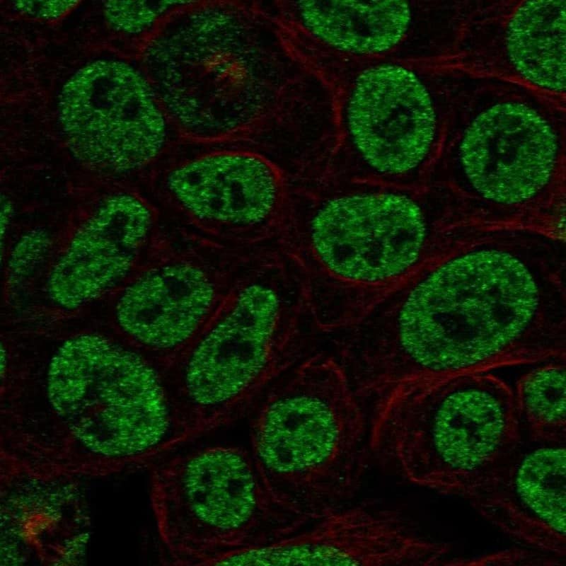 PIAS2 Antibody Immunocytochemistry/Immunofluorescence: PIAS2 Antibody [NBP3-25051]