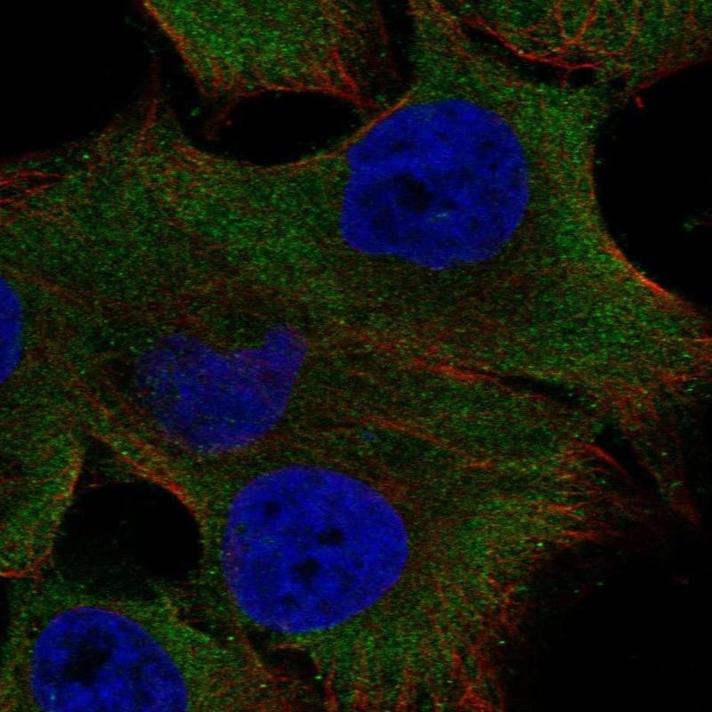 PKD2L1 Antibody Immunocytochemistry/Immunofluorescence: PKD2L1 Antibody [NBP3-25054]