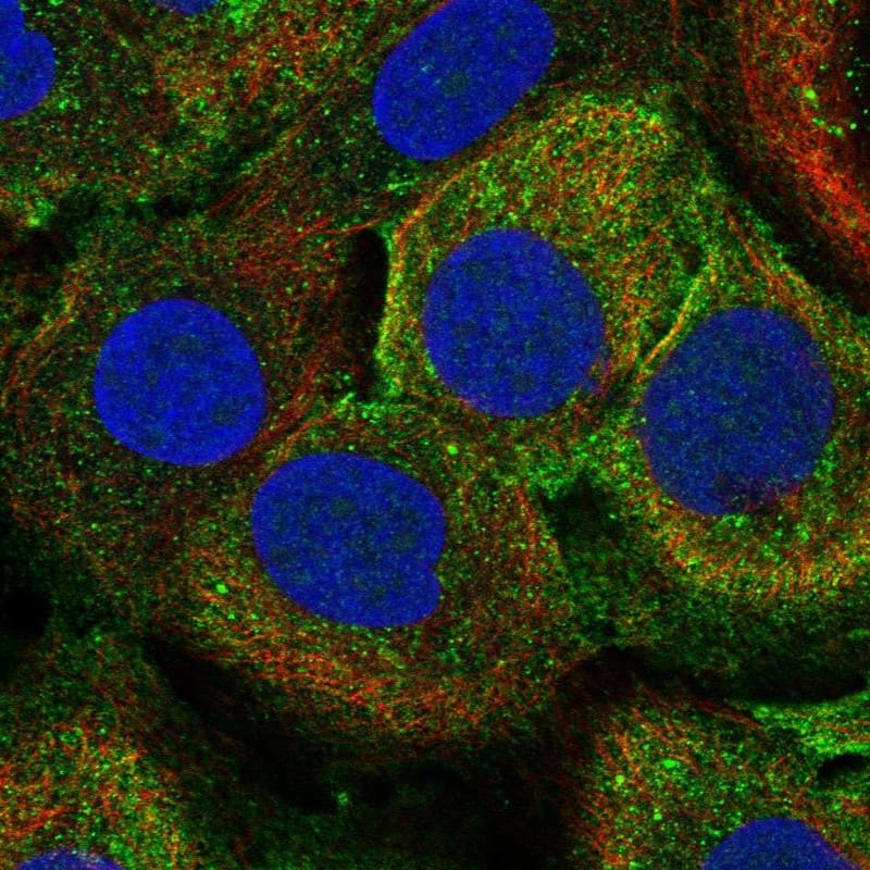 PLA2G4D Antibody Immunocytochemistry/Immunofluorescence: PLA2G4D Antibody [NBP3-25055]