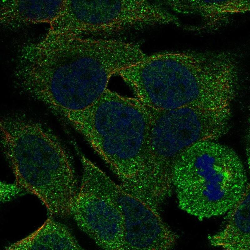 PLA2G4E Antibody Immunocytochemistry/Immunofluorescence: PLA2G4E Antibody [NBP3-25056]