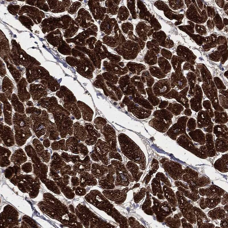 PLOD3 Antibody Immunohistochemistry-Paraffin: PLOD3 Antibody [NBP3-25058]