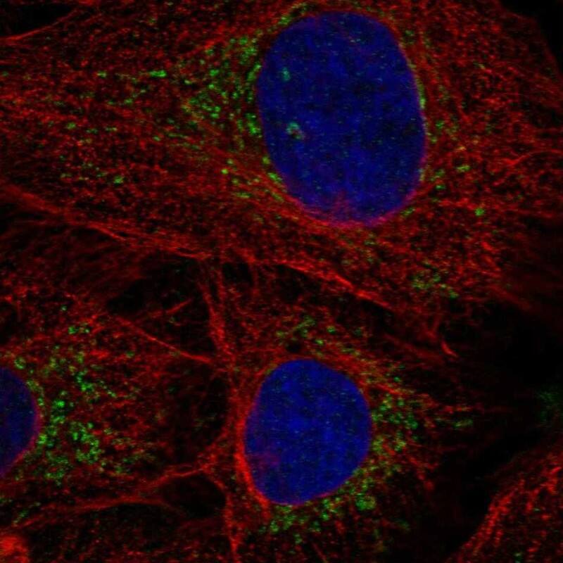 POLG2 Antibody Immunocytochemistry/Immunofluorescence: POLG2 Antibody [NBP3-25059]