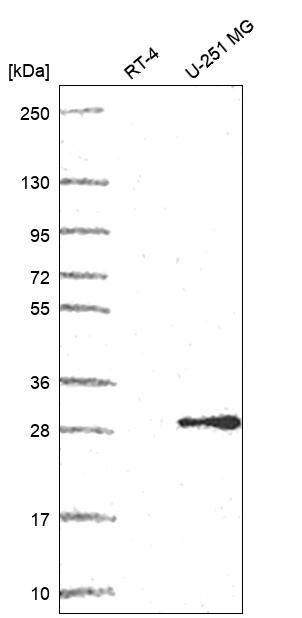POP4 Antibody Western Blot: POP4 Antibody [NBP3-25060]
