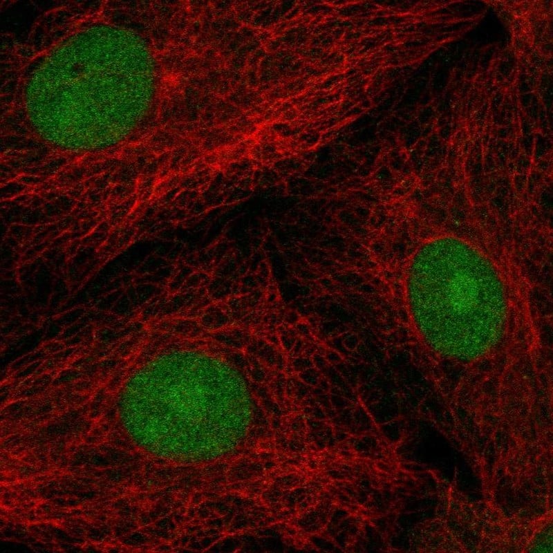 POP4 Antibody Immunocytochemistry/Immunofluorescence: POP4 Antibody [NBP3-25060]