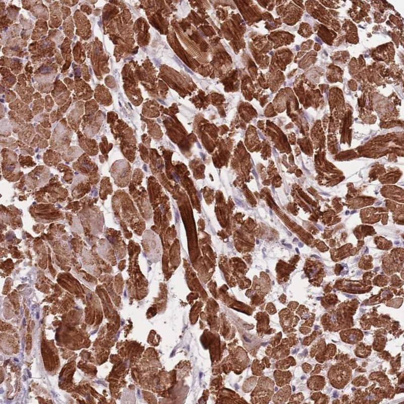 PP14C Antibody Immunohistochemistry-Paraffin: PP14C Antibody [NBP3-25061]