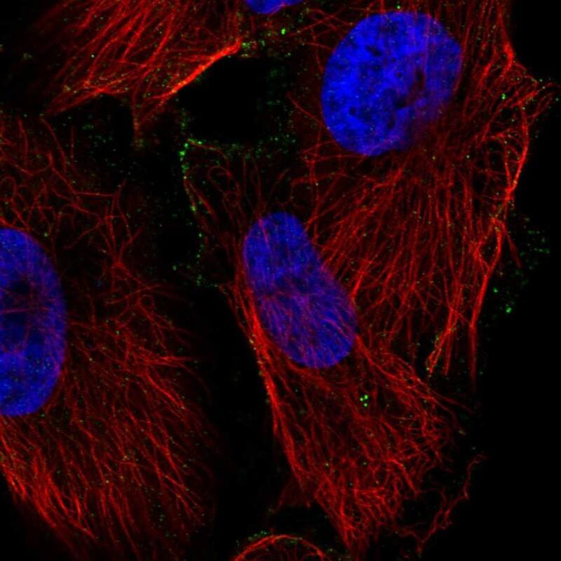 PPAP2C Antibody Immunocytochemistry/Immunofluorescence: PPAP2C Antibody [NBP3-25062]