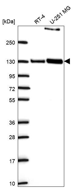 PPFIBP1 Antibody Western Blot: PPFIBP1 Antibody [NBP3-25063]