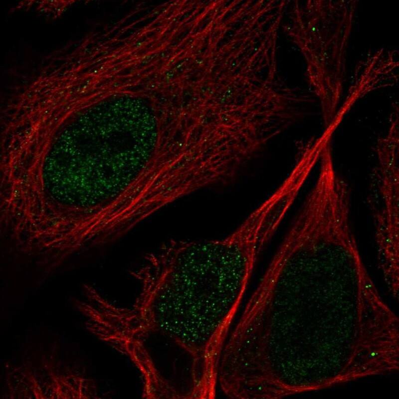 PPP1R3F Antibody Immunocytochemistry/Immunofluorescence: PPP1R3F Antibody [NBP3-25064]