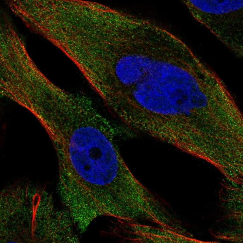 PPP3CC Antibody Immunocytochemistry/Immunofluorescence: PPP3CC Antibody [NBP3-25065]