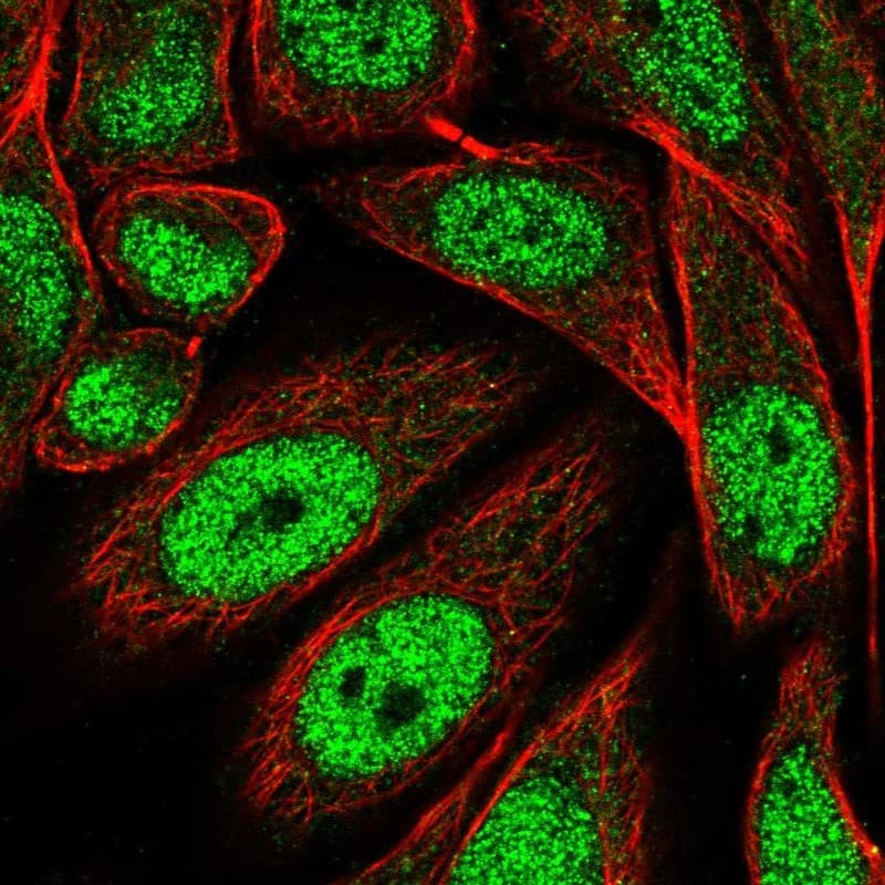 PRDM13 Antibody Immunocytochemistry/Immunofluorescence: PRDM13 Antibody [NBP3-25068]