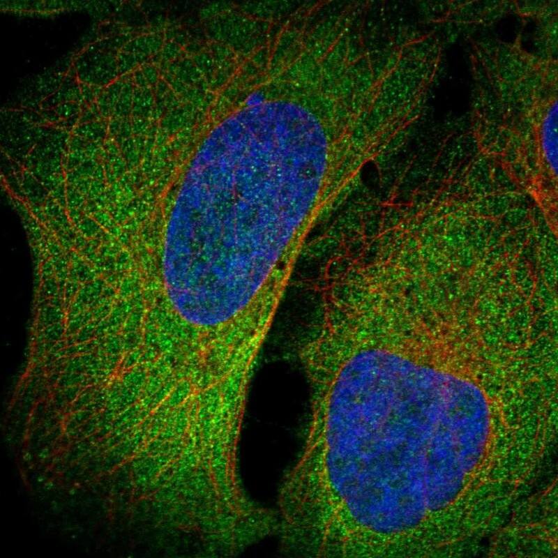 PRELP Antibody Immunocytochemistry/Immunofluorescence: PRELP Antibody [NBP3-25069]