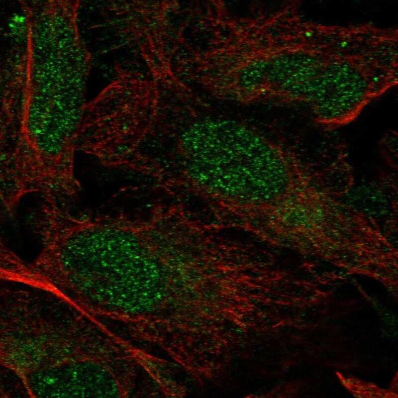 PRPF39 Antibody Immunocytochemistry/Immunofluorescence: PRPF39 Antibody [NBP3-25073]