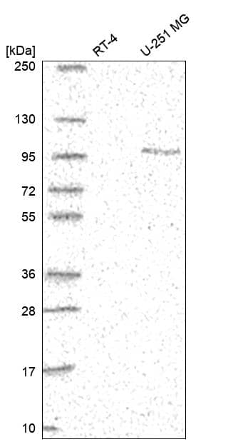 PSD-95 Antibody Western Blot: PSD-95 Antibody [NBP3-25075]
