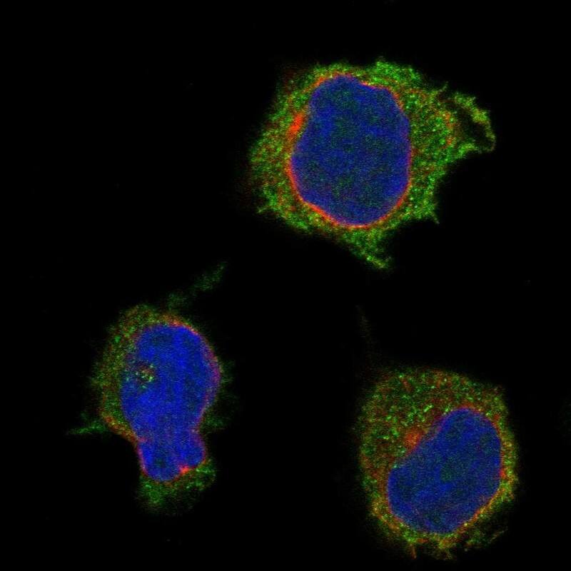 PSTPIP1 Antibody Immunocytochemistry/Immunofluorescence: PSTPIP1 Antibody [NBP3-25077]