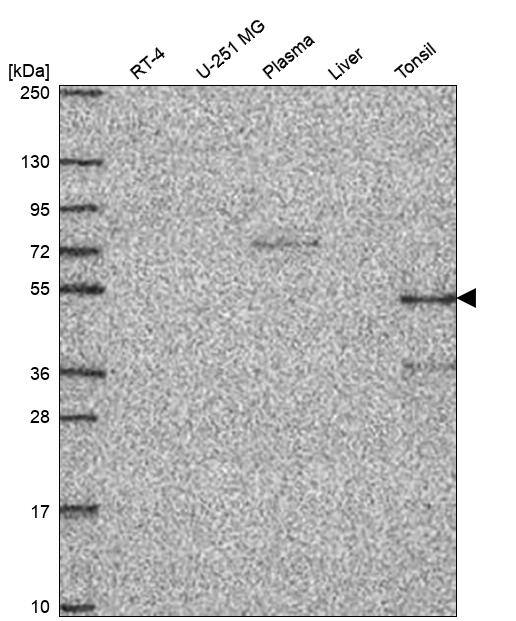 PSTPIP1 Antibody Western Blot: PSTPIP1 Antibody [NBP3-25078]