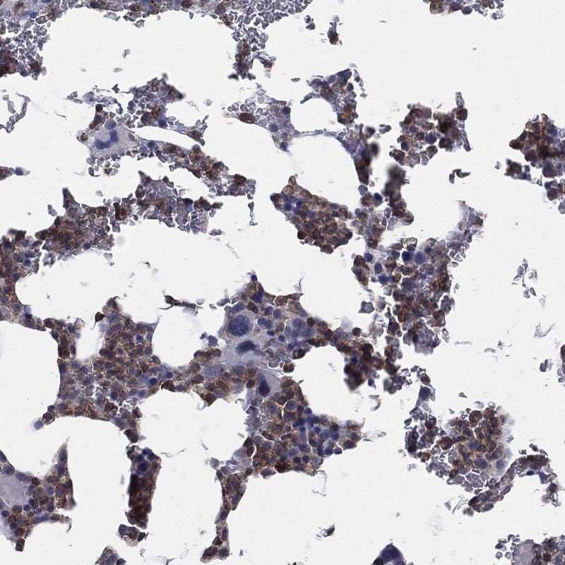 PSTPIP1 Antibody Immunohistochemistry-Paraffin: PSTPIP1 Antibody [NBP3-25078]