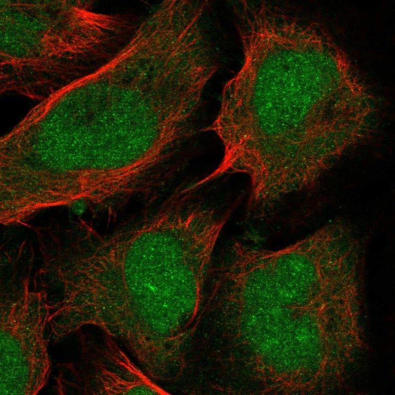 PTF1A Antibody Immunocytochemistry/Immunofluorescence: PTF1A Antibody [NBP3-25079]