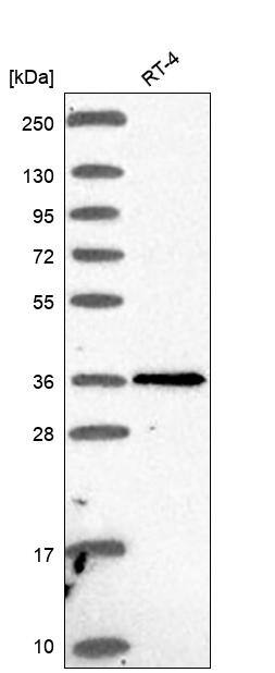 PTGDR Antibody Western Blot: PTGDR Antibody [NBP3-25080]