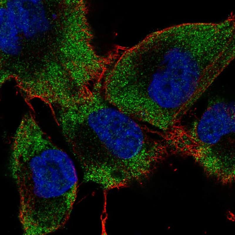 Rab24 Antibody Immunocytochemistry/Immunofluorescence: Rab24 Antibody [NBP3-25083]