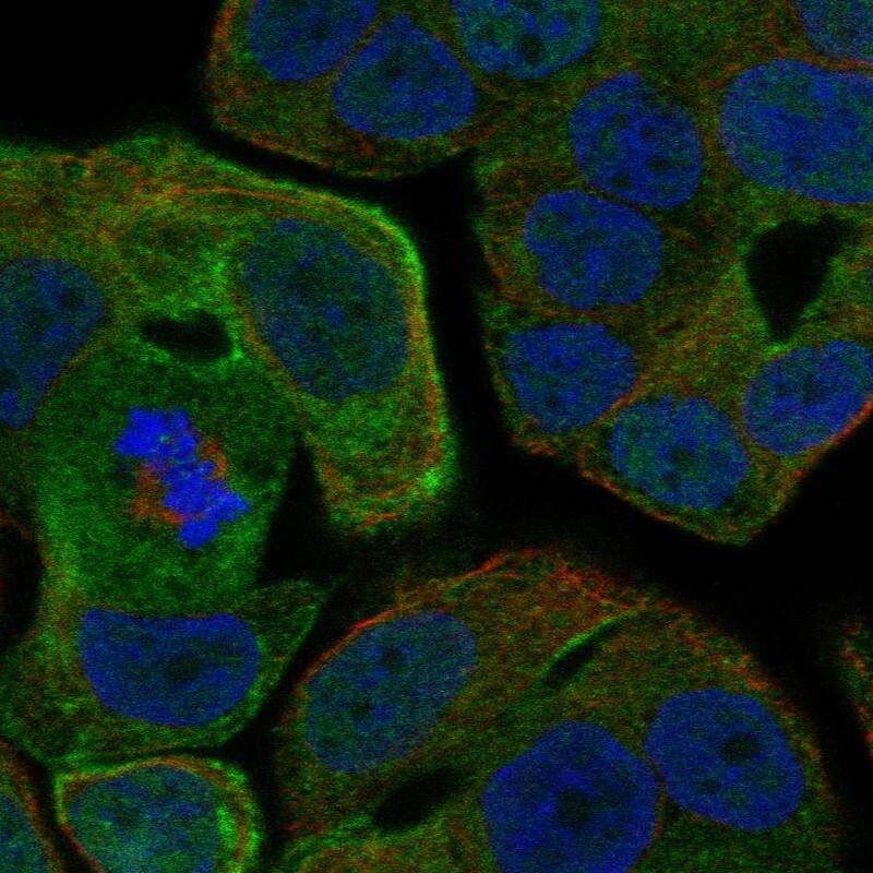 Rab25 Antibody Immunocytochemistry/Immunofluorescence: Rab25 Antibody [NBP3-25084]