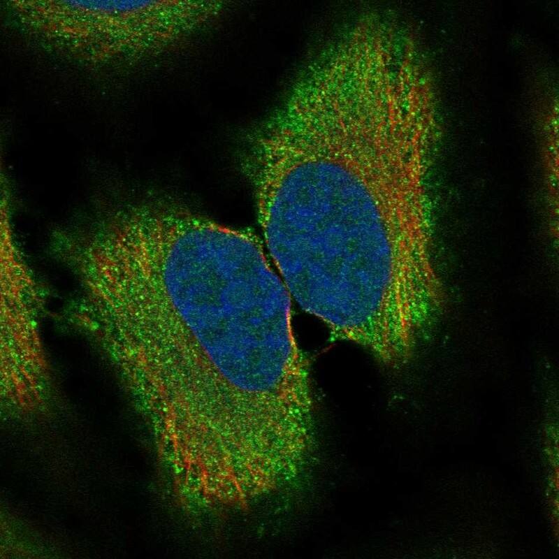 RAB41 Antibody Immunocytochemistry/Immunofluorescence: RAB41 Antibody [NBP3-25085]