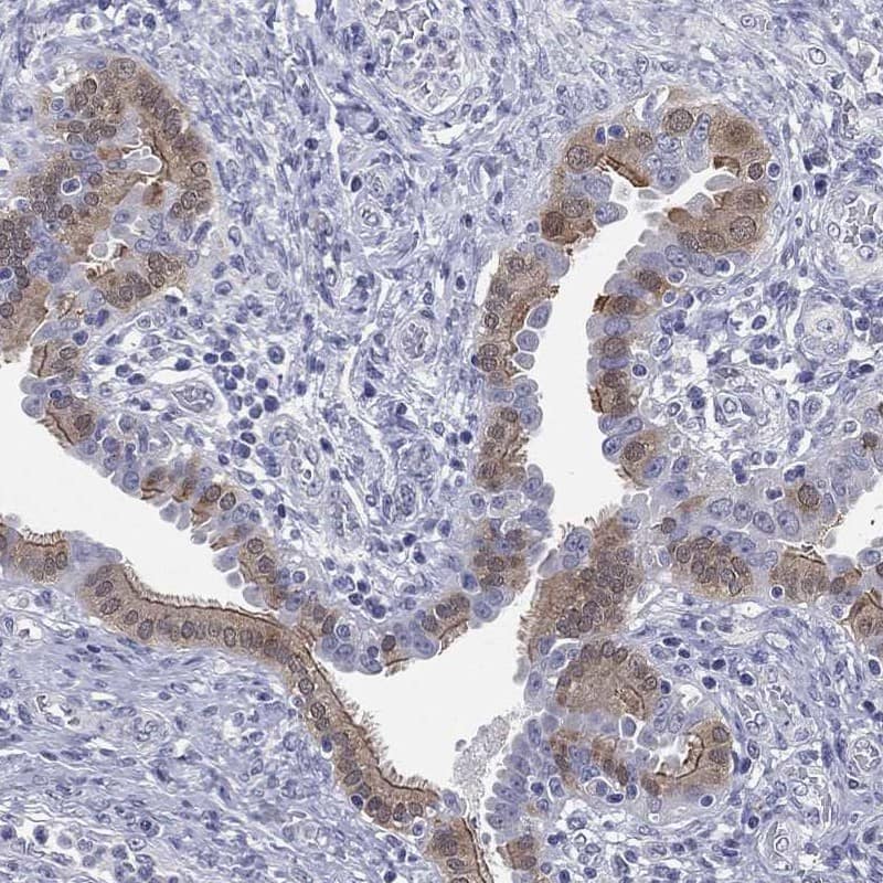 RABL4 Antibody Immunohistochemistry-Paraffin: RABL4 Antibody [NBP3-25088]