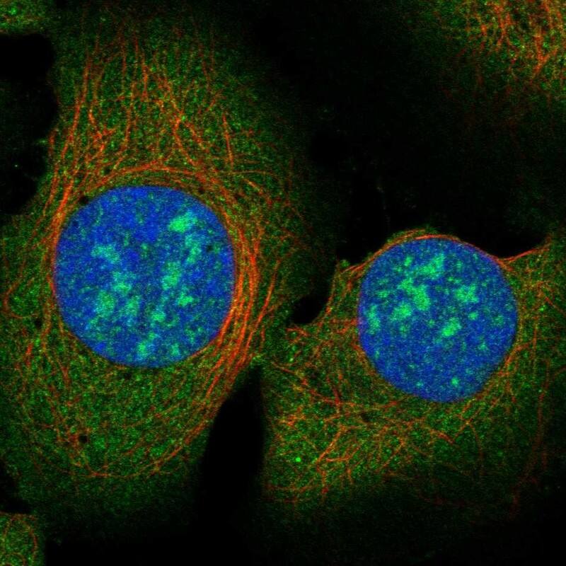 RAD51 Associated Protein 2 Antibody Immunocytochemistry/Immunofluorescence: RAD51 Associated Protein 2 Antibody [NBP3-25090]