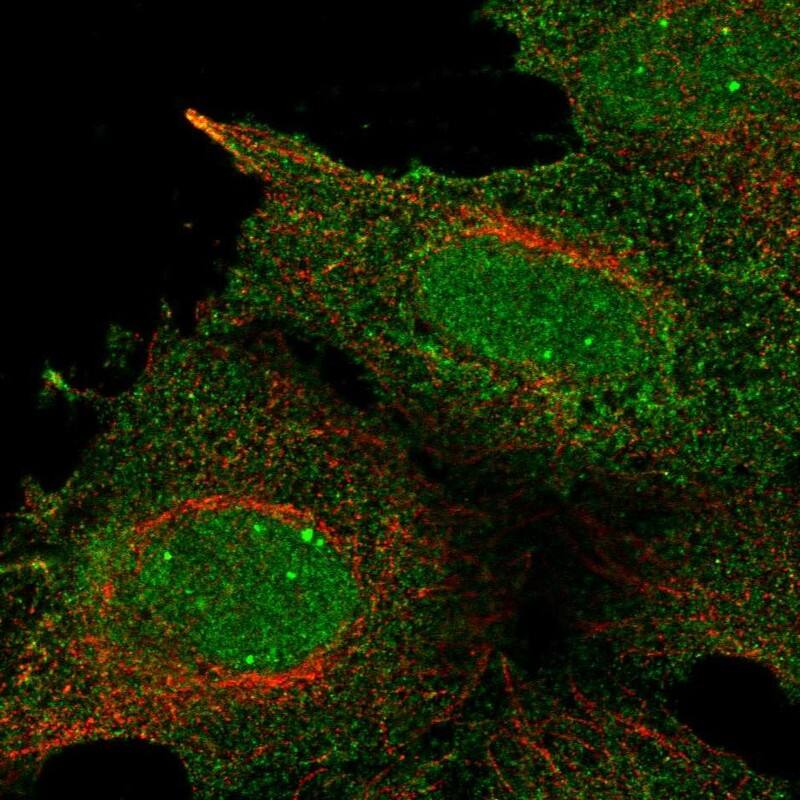 RALBP1 Antibody Immunocytochemistry/Immunofluorescence: RALBP1 Antibody [NBP3-25091]